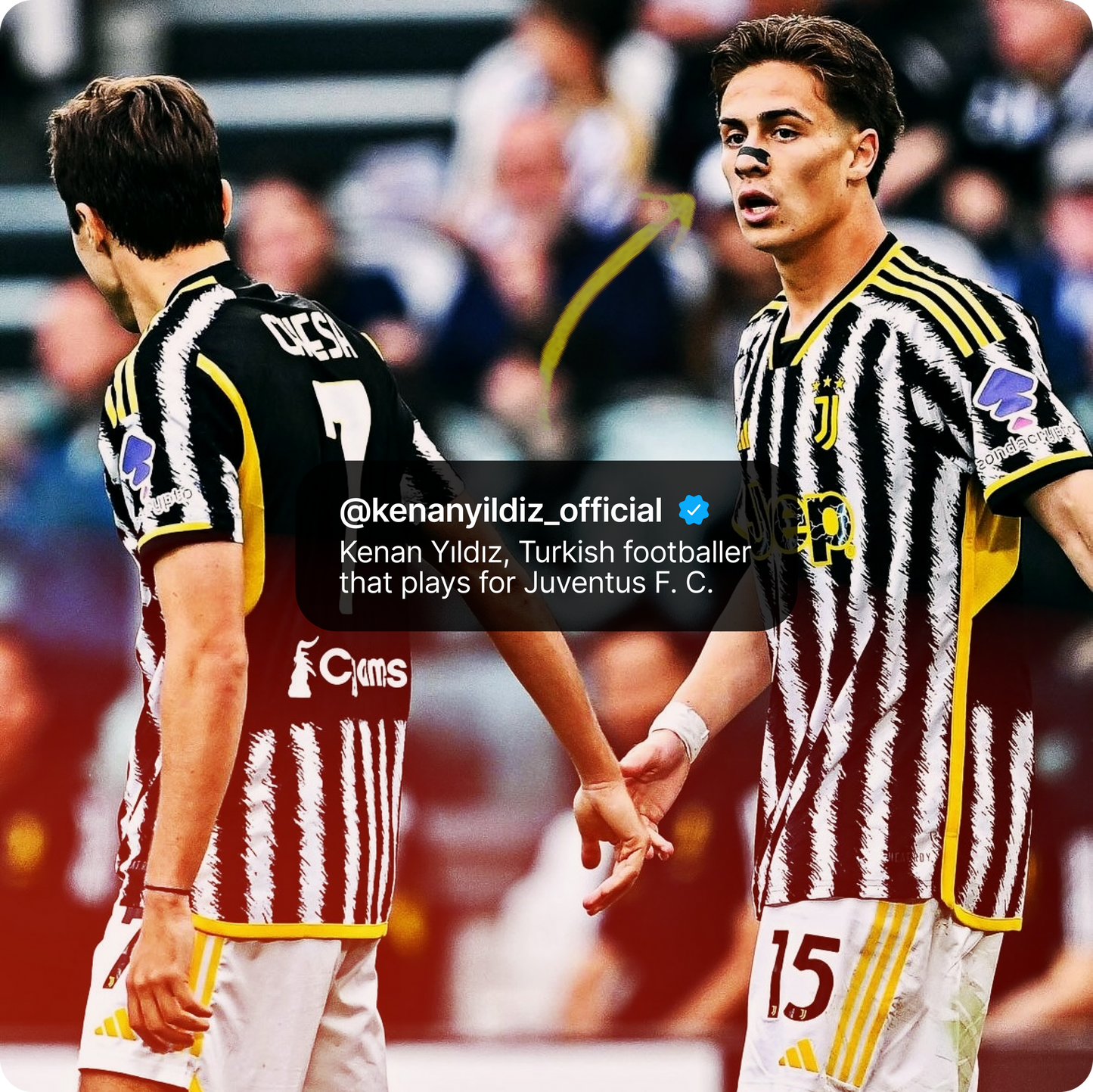 Nosetalgia Nose Strips